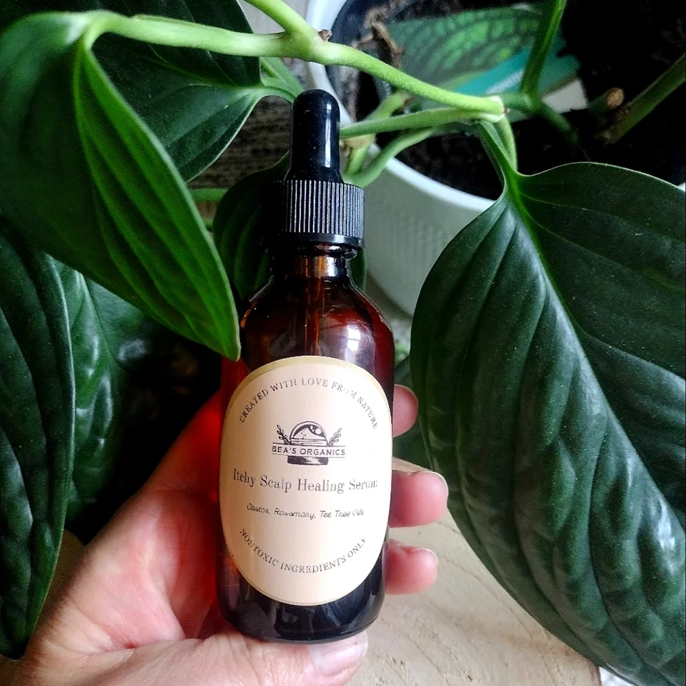 Itchy Scalp Healing Serum, dandruff, dry skin, hair loss